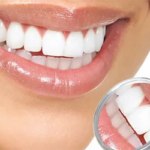 Dental Mouth Mirror Plain